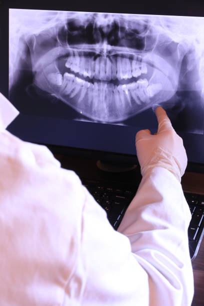 Best Emergency Root Canal Treatment in Waynesville, OH